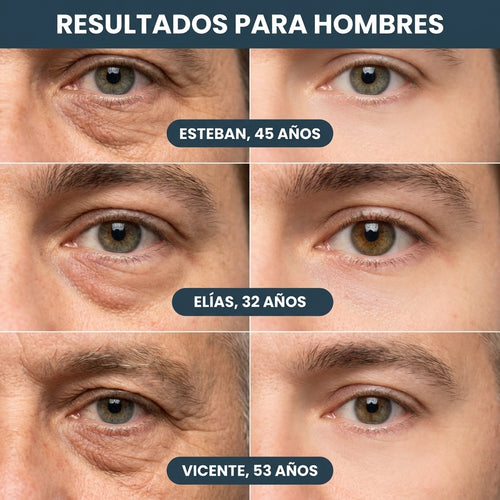 Parches Anti-Ojeras Nueva Generación